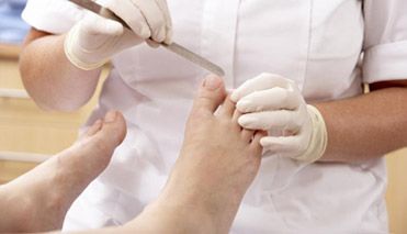 Clínica del Pie Valdepasillas arreglando uña del pie